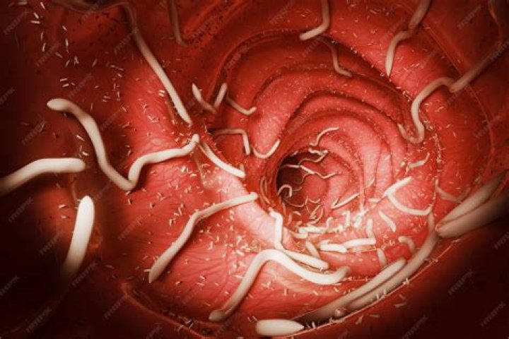 Does bleach kill roundworm?