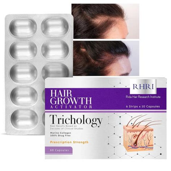 Does camel hair pill?