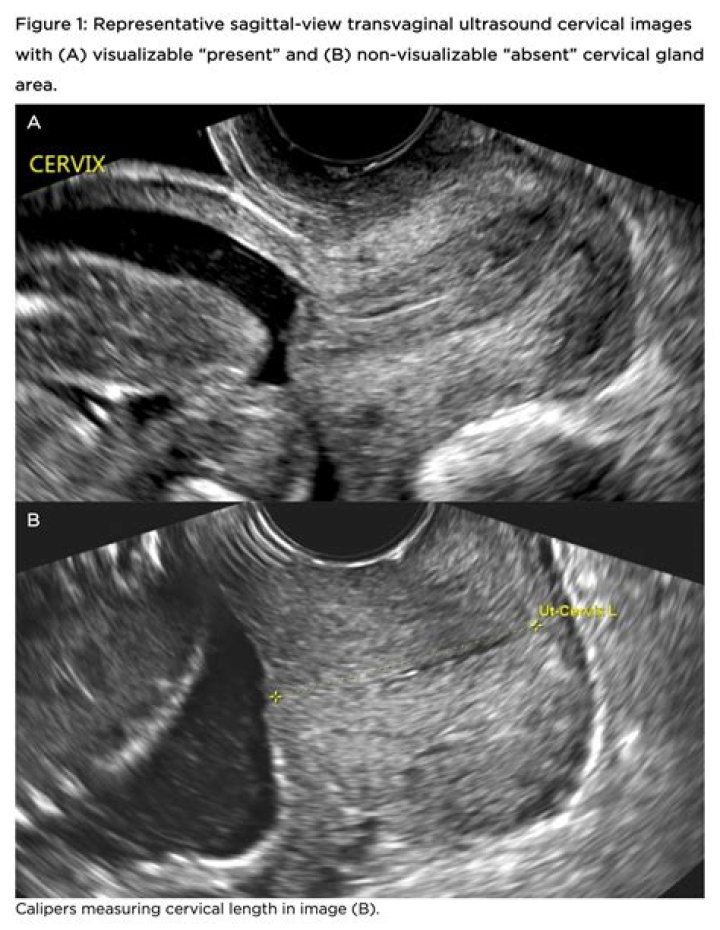 Does cervix close after fertilization?