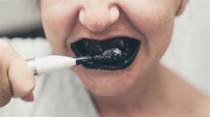 Does charcoal really whiten teeth?