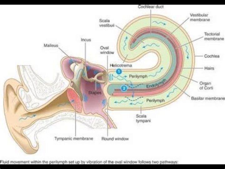 Does cochlear hydrops go away?