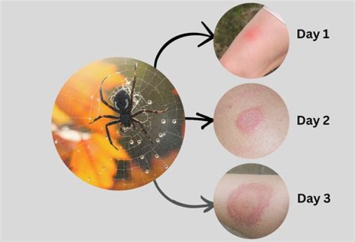 Does ehrlich treat spiders?
