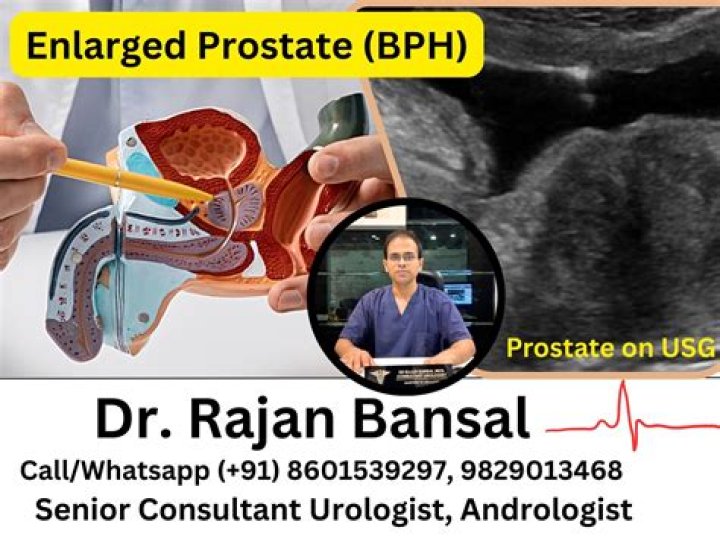 Does enlarged prostate go away?
