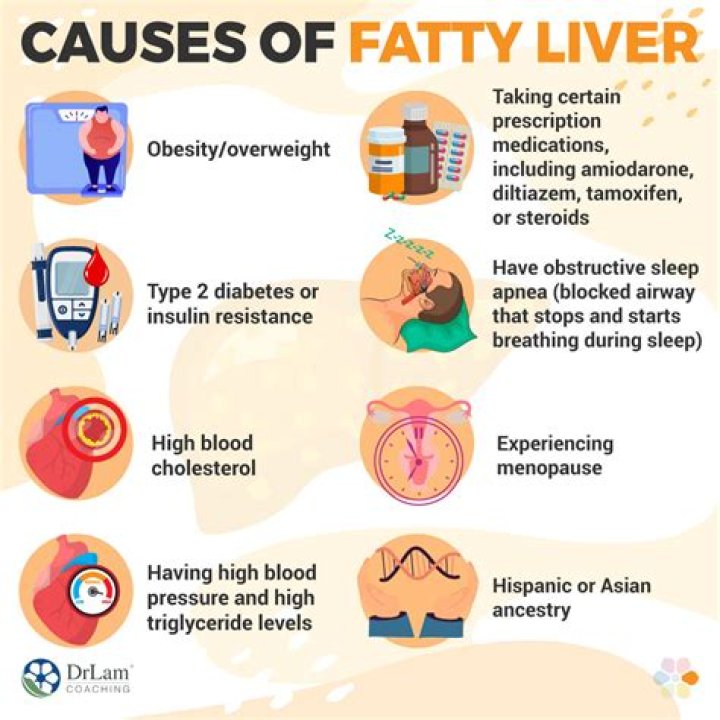 Does fatty liver causes splenomegaly?