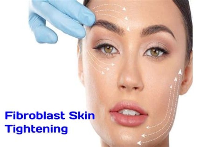 Does fibroblast skin tightening work?