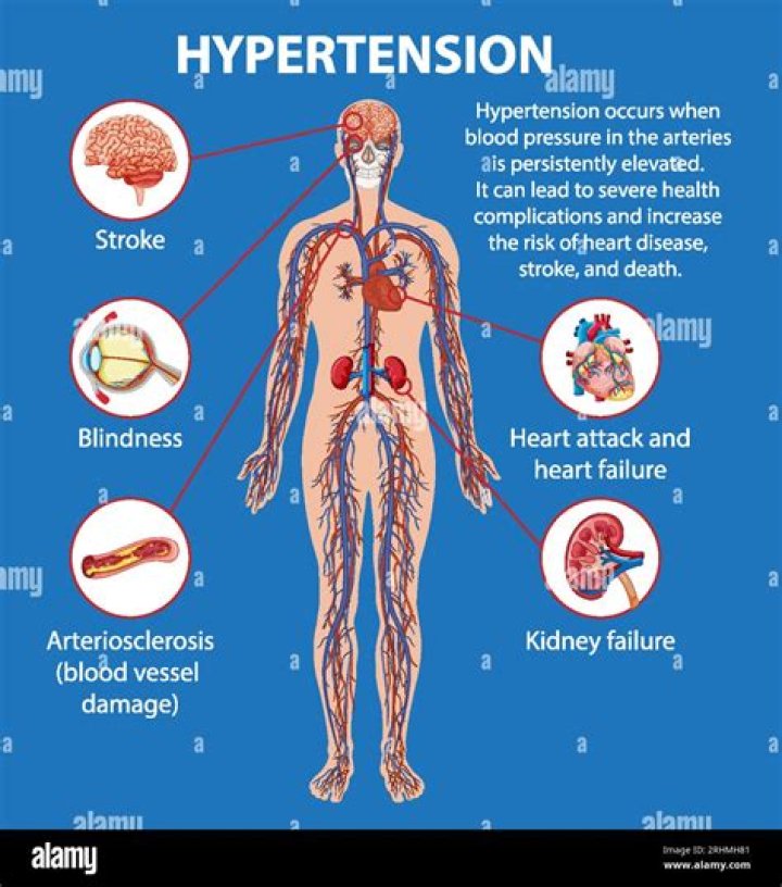 Does hypertension cause fatigue?