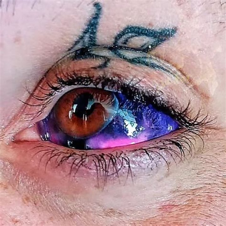 Does it hurt to get your eyes tattooed?