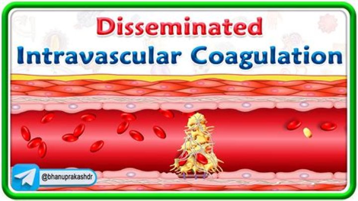 Does iv mean intravascular?