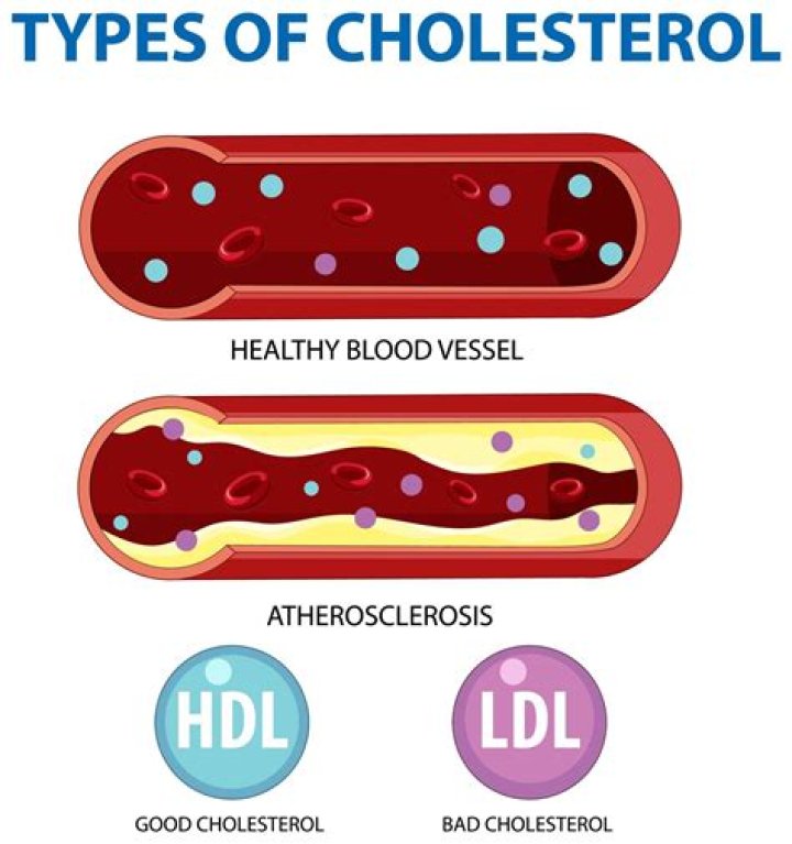 Does jeera reduce cholesterol?