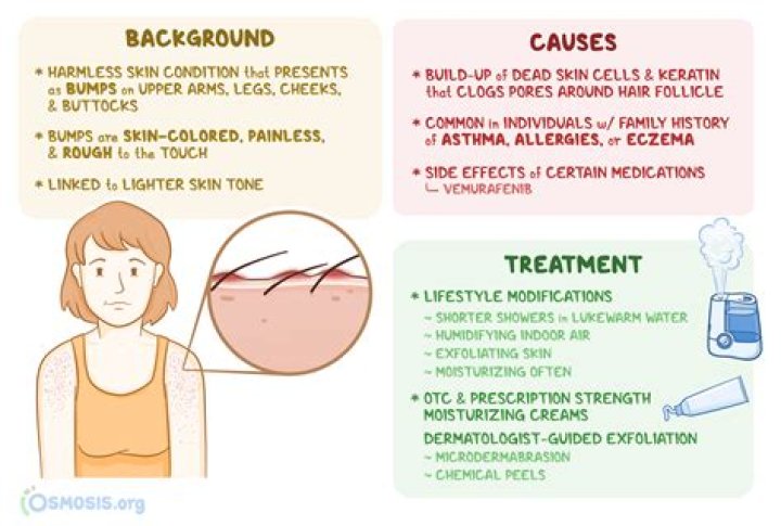 Does keratosis pilaris go away?