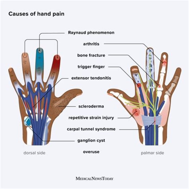 Does left hand have a hyphen?