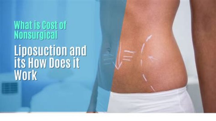 Does liposuction cause dimpling?