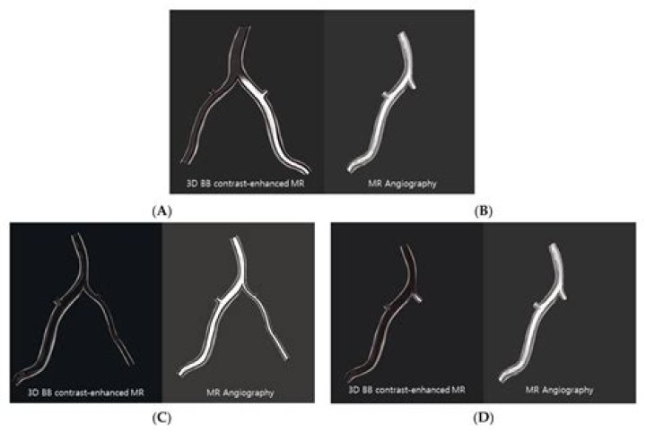 Does mr angiography use contrast?