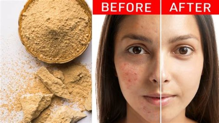 Does multani mitti remove tan?