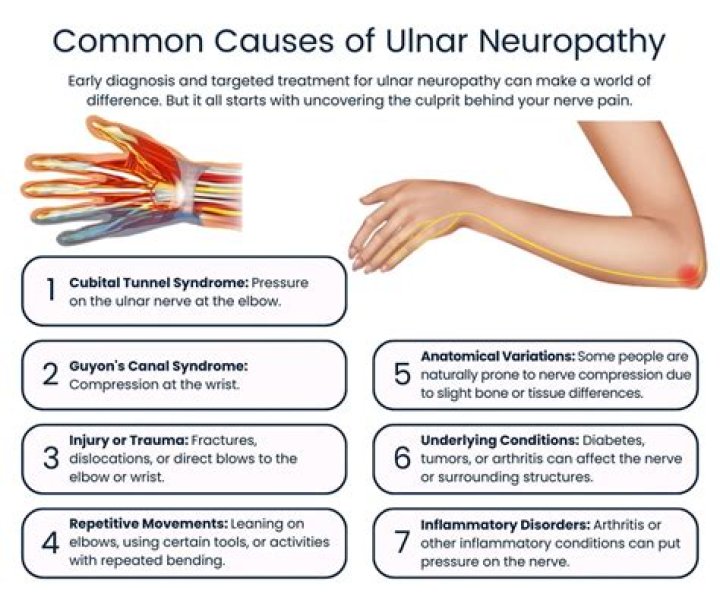 Does neuritis go away?