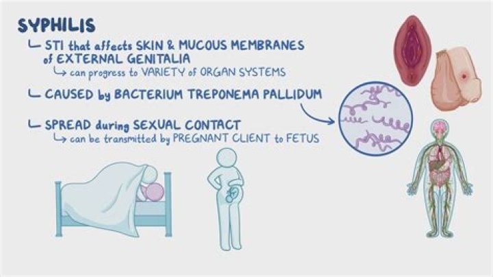 Does neurosyphilis have a cure?