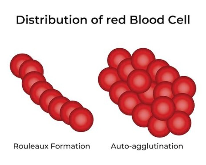 Does o blood agglutinate?