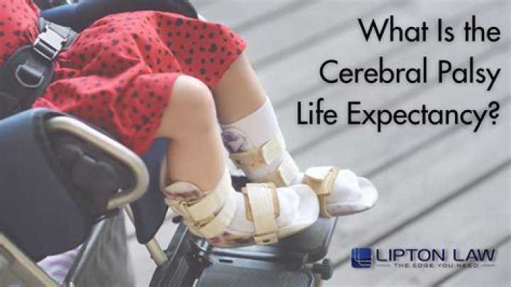 Does paraplegia shorten life expectancy?