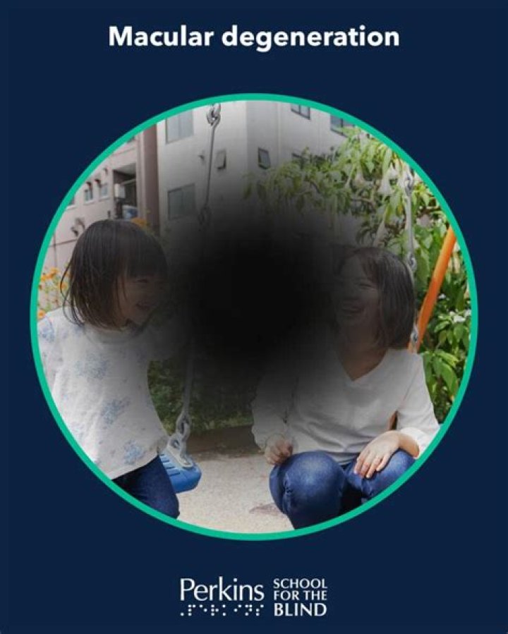 Does sasuke go blind?