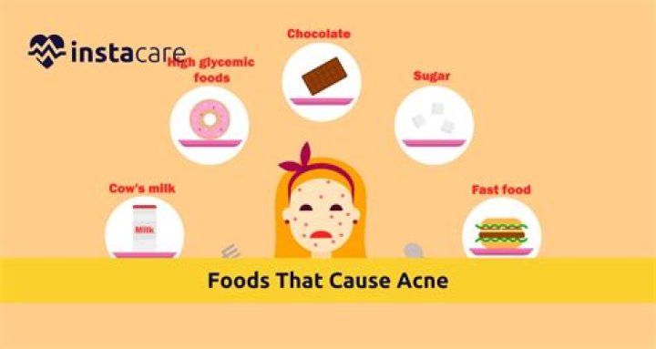 Does spicy food cause acne?