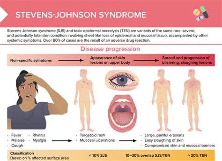 Does sundowners syndrome go away?
