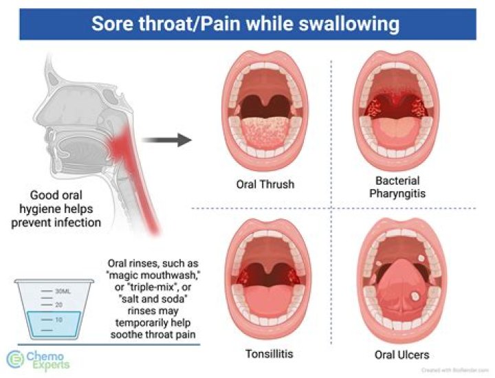 Does swabbing your throat hurt?