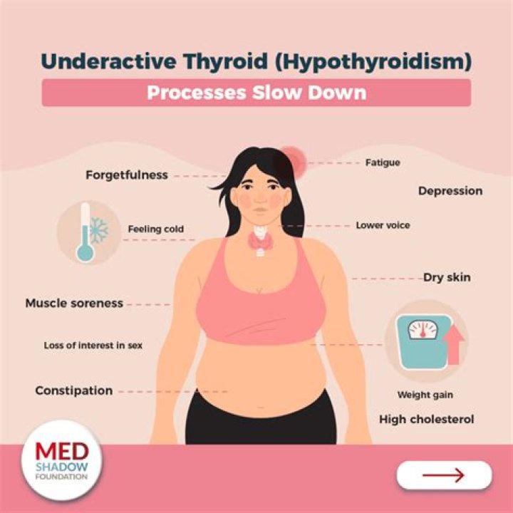 Does thyroids cause headaches?