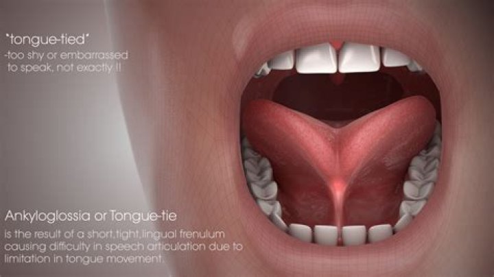Does tongue shape affect speech?