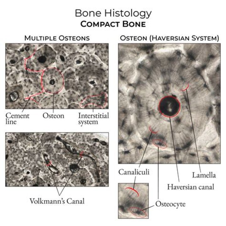 Does trabecular bone have osteons?