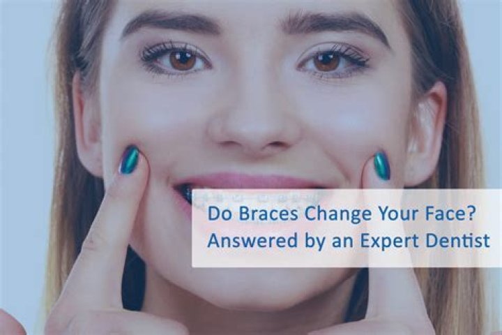 Does your face change with dentures?