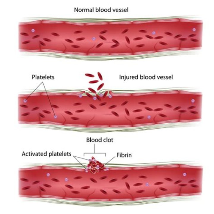 During blood clotting thromboplastin is produced by?