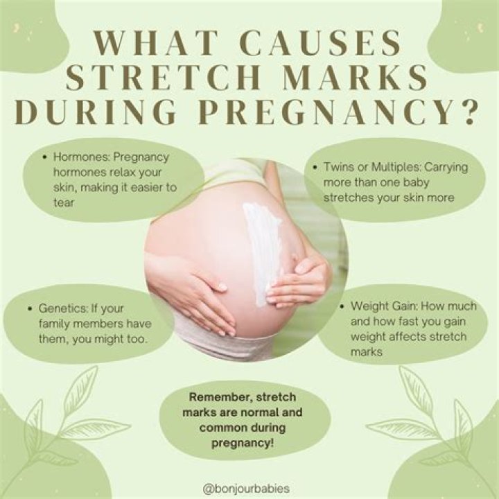 During pregnancy stretch marks?