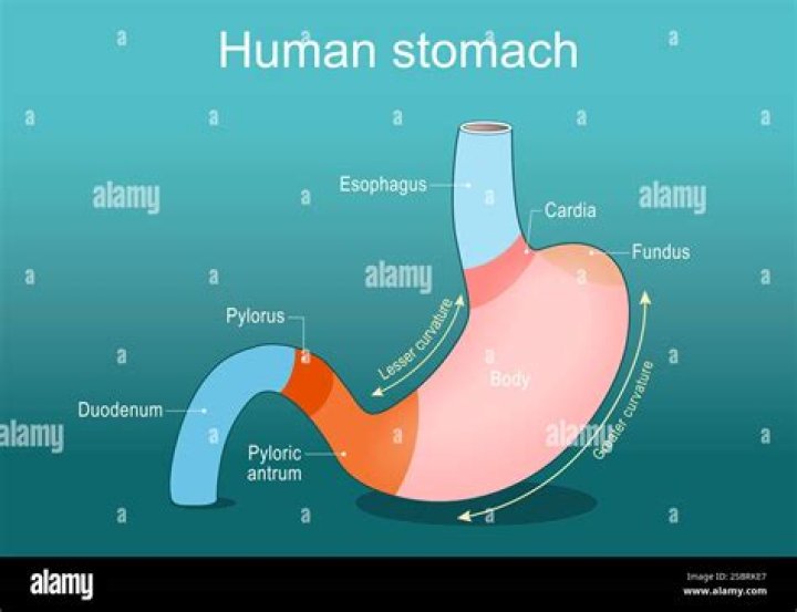 During which procedure is the stomach anastomosed with the duodenum?