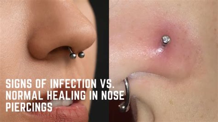For a nose piercing to heal?