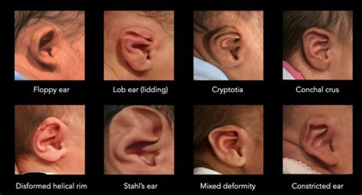 For be all ears?