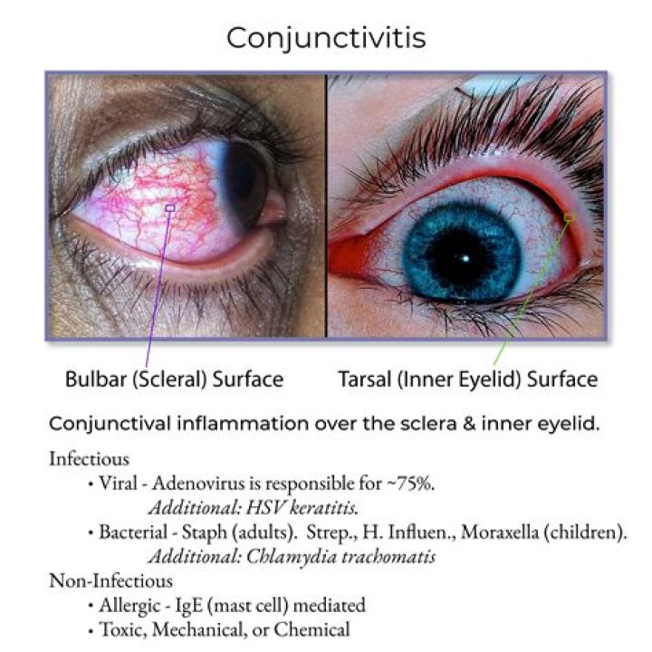 For how long is viral conjunctivitis contagious?