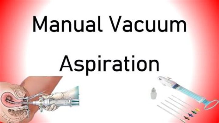 For manual vacuum aspiration?