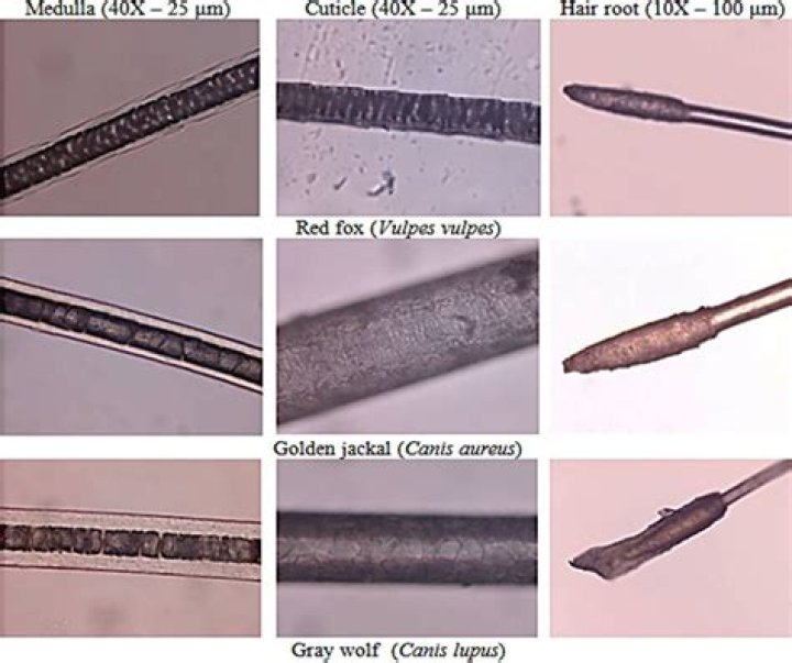 Has a striped appearance when viewed under the microscope?