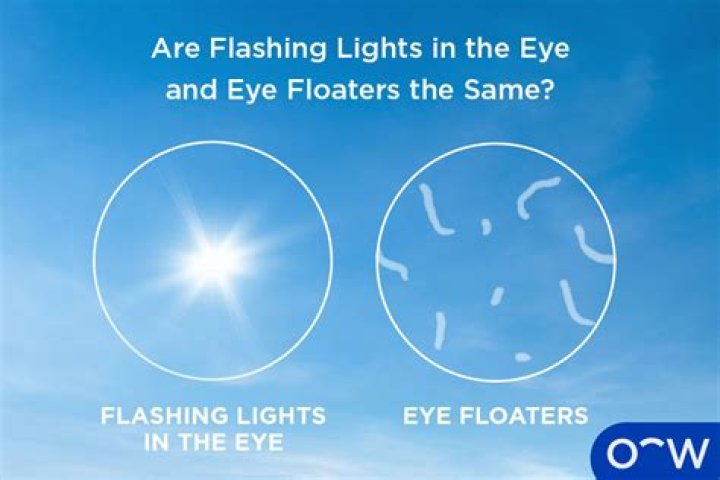 Has anyone cured floaters?