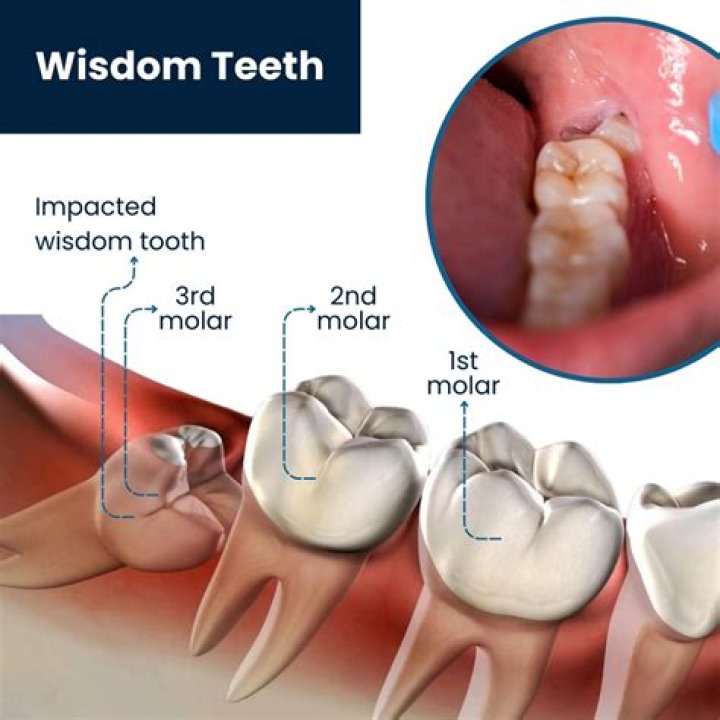 Has continuously growing teeth?