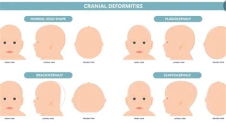 Has cranium been updated?