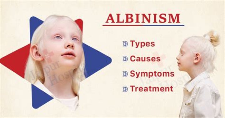 How albinism is diagnosed?