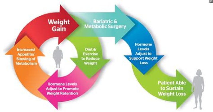 How bariatric surgery overcome obesity?