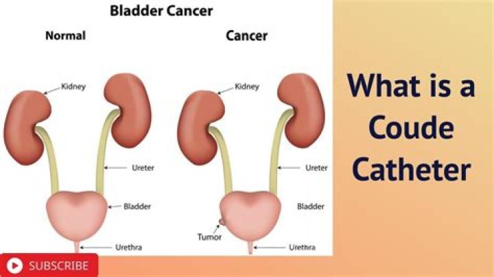 How does a coude catheter work?