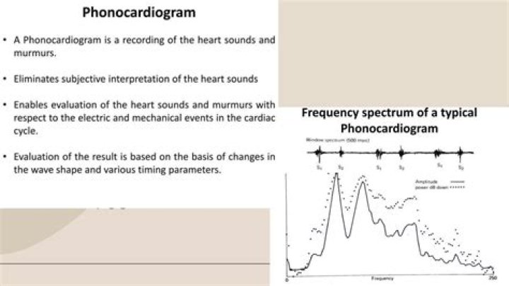 How does a phonocardiogram work?