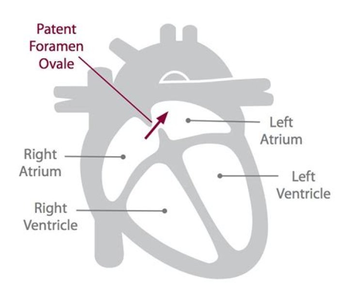 How does foramen ovale work?