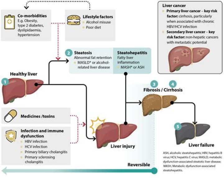 How does liver rot occurs?
