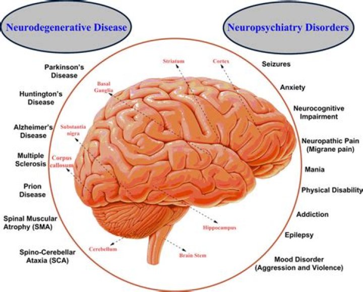 How does neurodegenerative disease work?