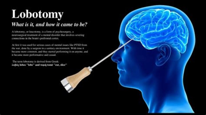 How does someone act after a lobotomy?
