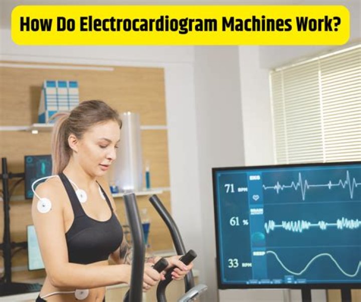 How electrocardiogram machine works?
